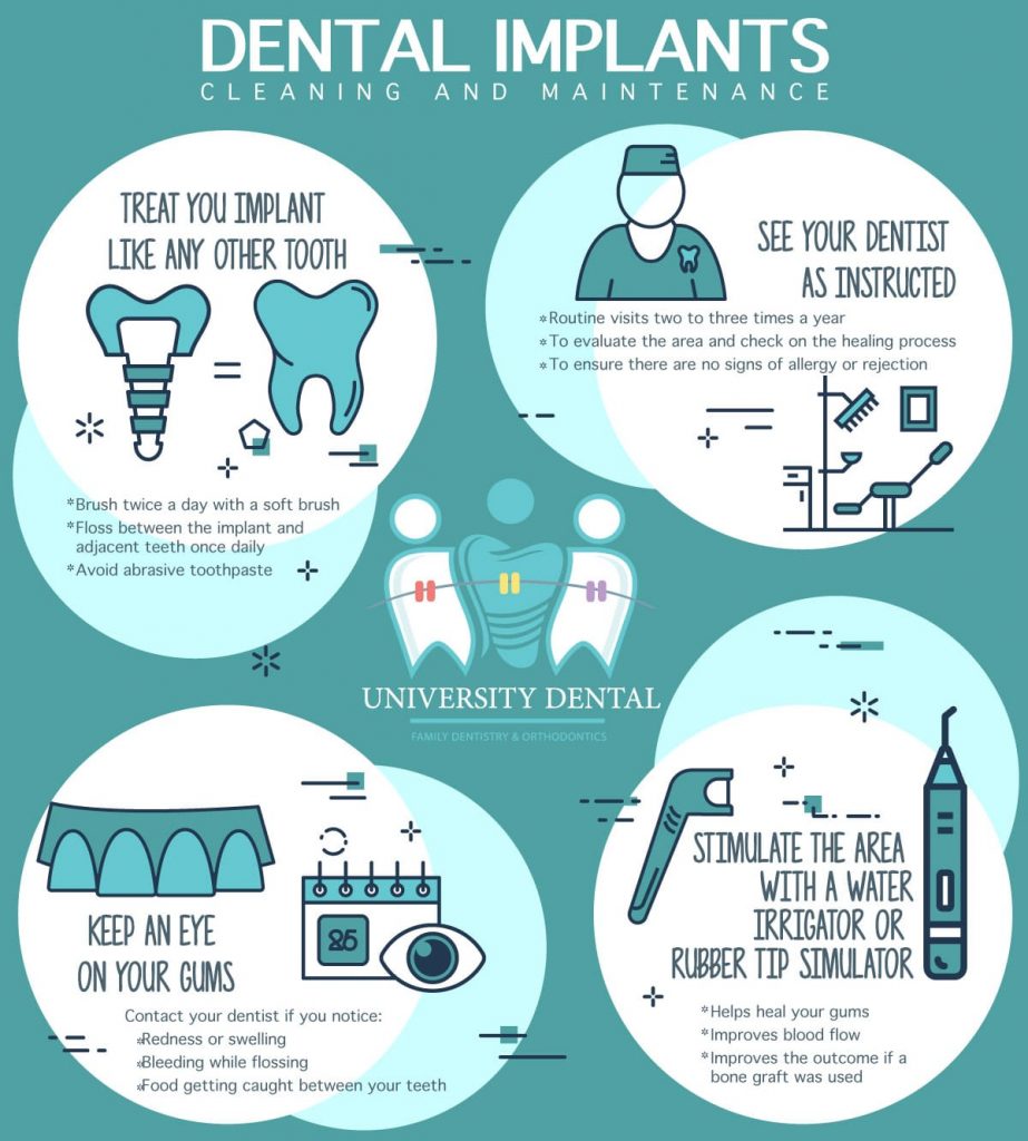 Illustrative example of how to care for dental implants from Google Search