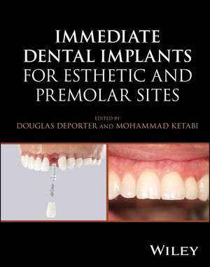 Illustrative example of immediate dental implants from Google Search