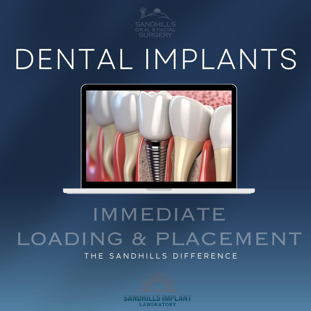 Illustrative example of immediate load dental implants from Google Search