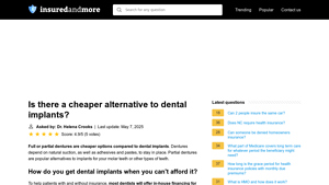 Is there a cheaper alternative to dental implants? - InsuredAndMore.com - cheaper alternative to dental implants