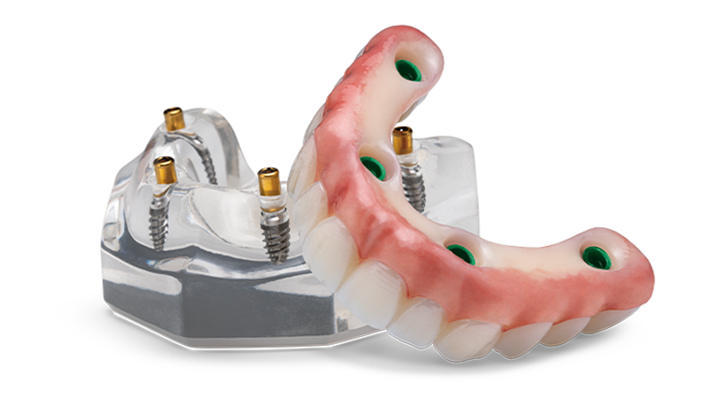 Illustrative example of locator dental implant from Google Search