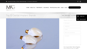 Top 10 Dental Implant Brands - Ranking - best dental implants brand