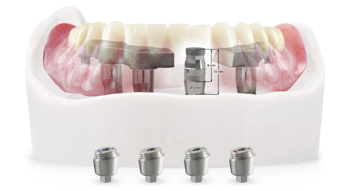 Illustrative example of magnetic dental implants from Google Search