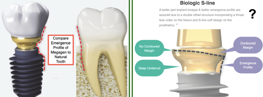 Illustrative example of megagen dental implants from Google Search