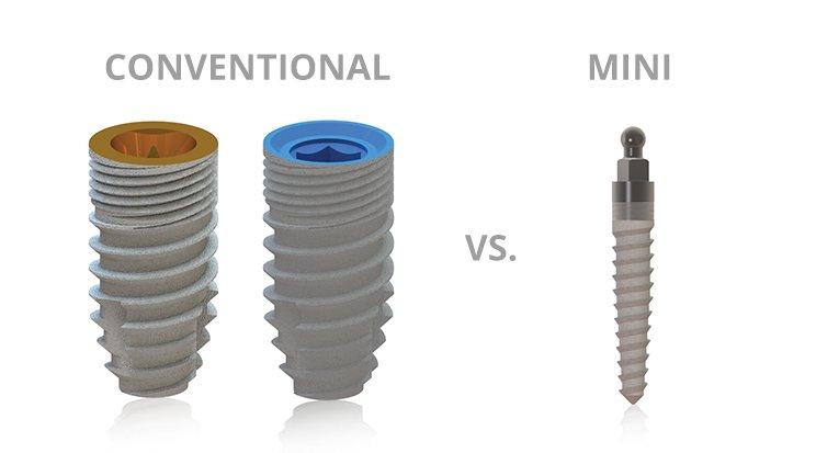 Illustrative example of mini dental implants vs traditional implants from Google Search