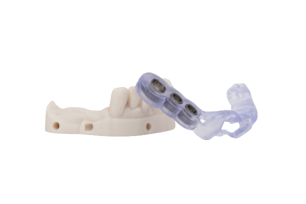 Illustrative example of new dental implant technology from Google Search