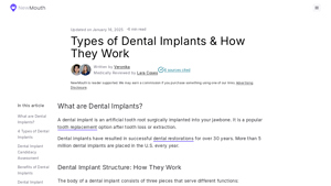 4 Types of Dental Implants (Procedure, Costs, Pros & Cons) - best dentist for dental implants
