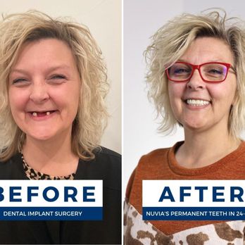 Illustrative example of nuvia dental implant reviews complaints from Google Search