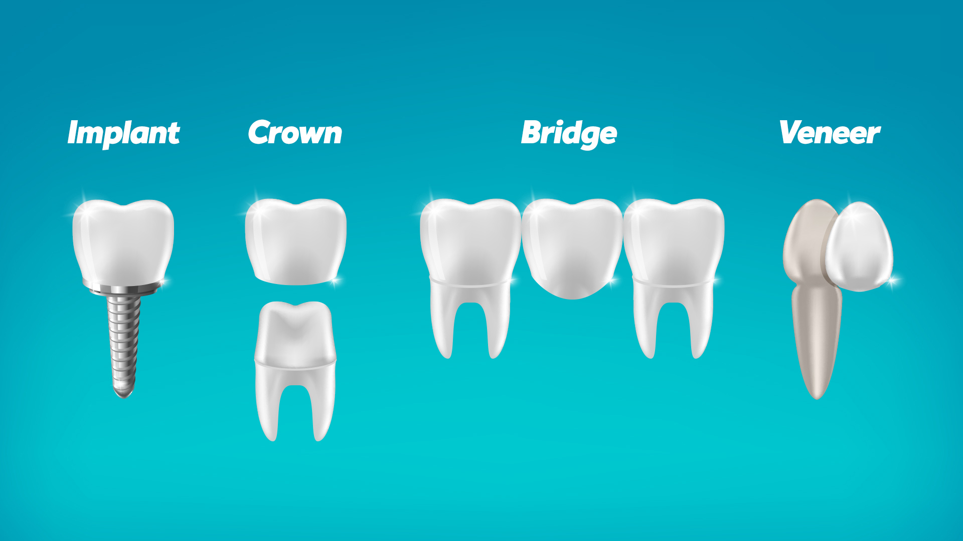 Illustrative example of options other than dental implants from Google Search