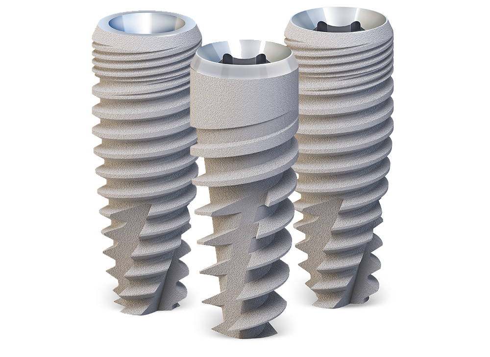 Illustrative example of paltop dental implants from Google Search