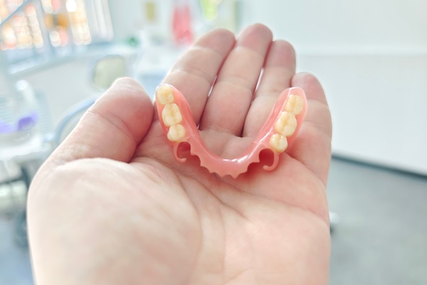 Illustrative example of partial dental implants from Google Search