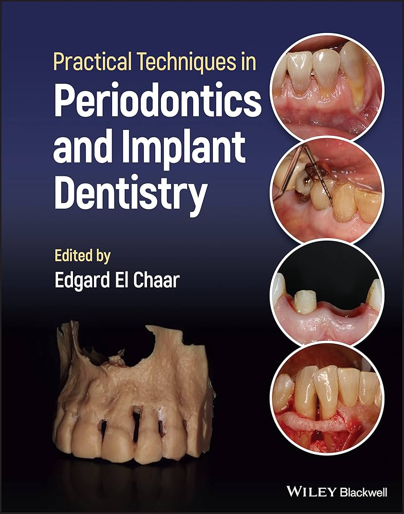 Illustrative example of periodontics and dental implants from Google Search