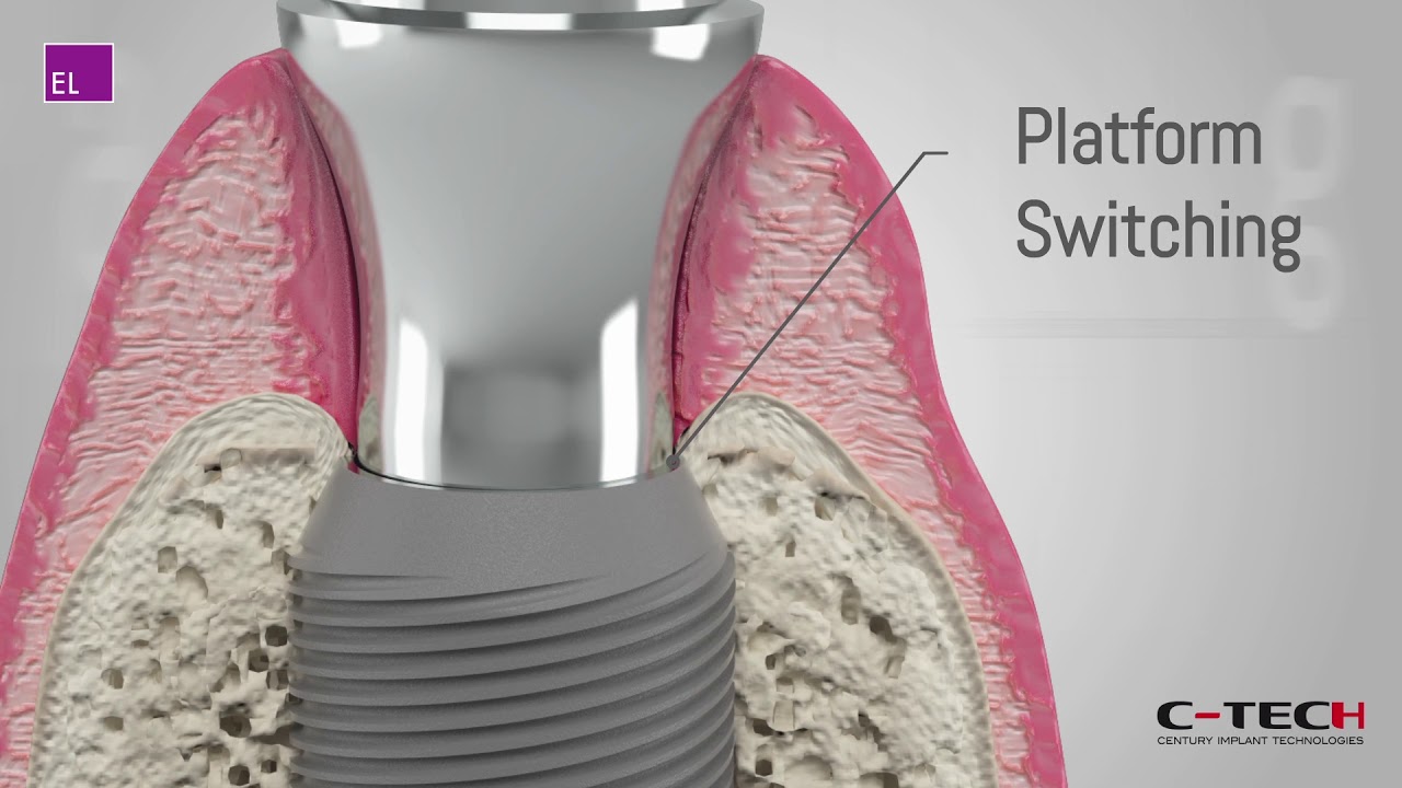 Illustrative example of platform switching dental implants from Google Search