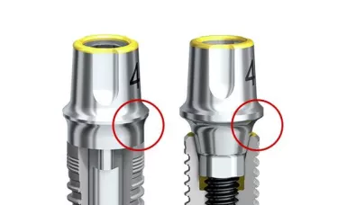 Illustrative example of platform switching dental implants from Google Search
