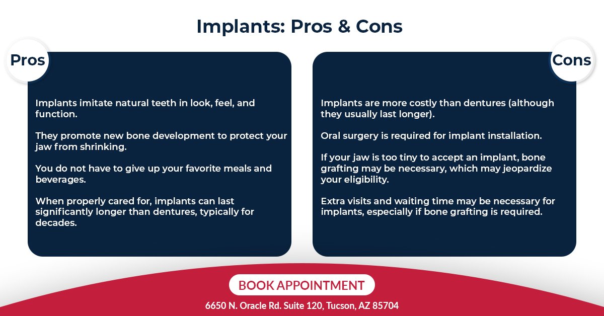 Illustrative example of pros and cons of dental implants from Google Search