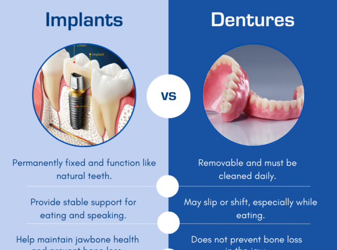 Illustrative example of pros and cons of dental implants vs dentures from Google Search