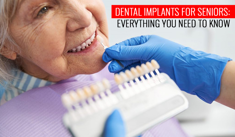 Illustrative example of senior dental implants from Google Search