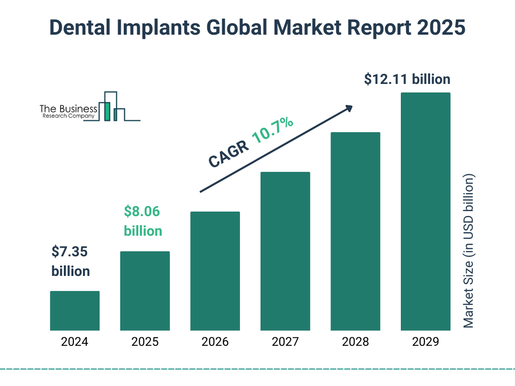 Illustrative example of sr dental implants from Google Search