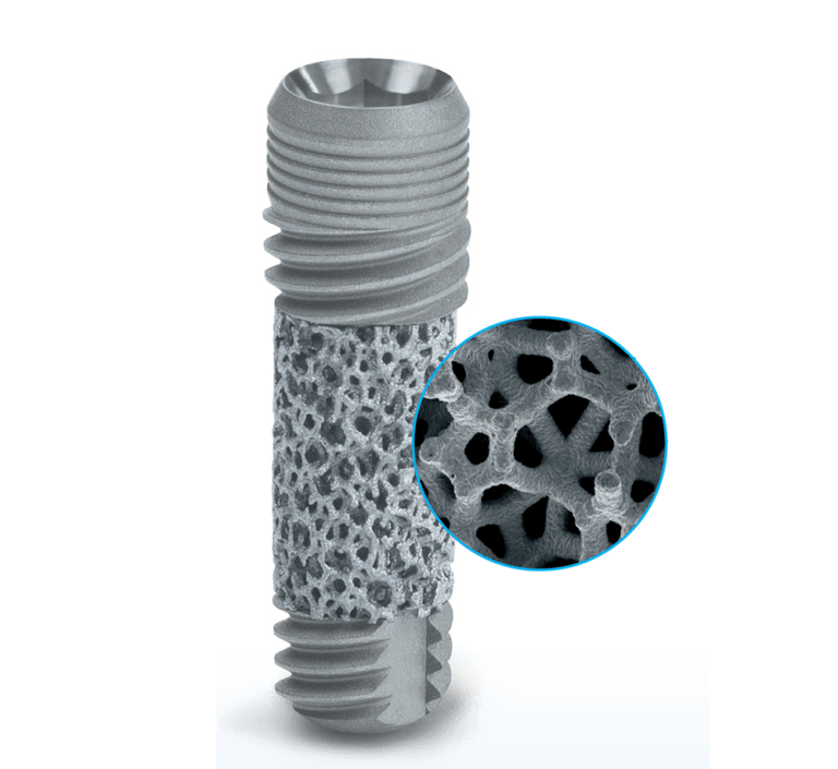 Illustrative example of zimmer biomet dental implants from Google Search