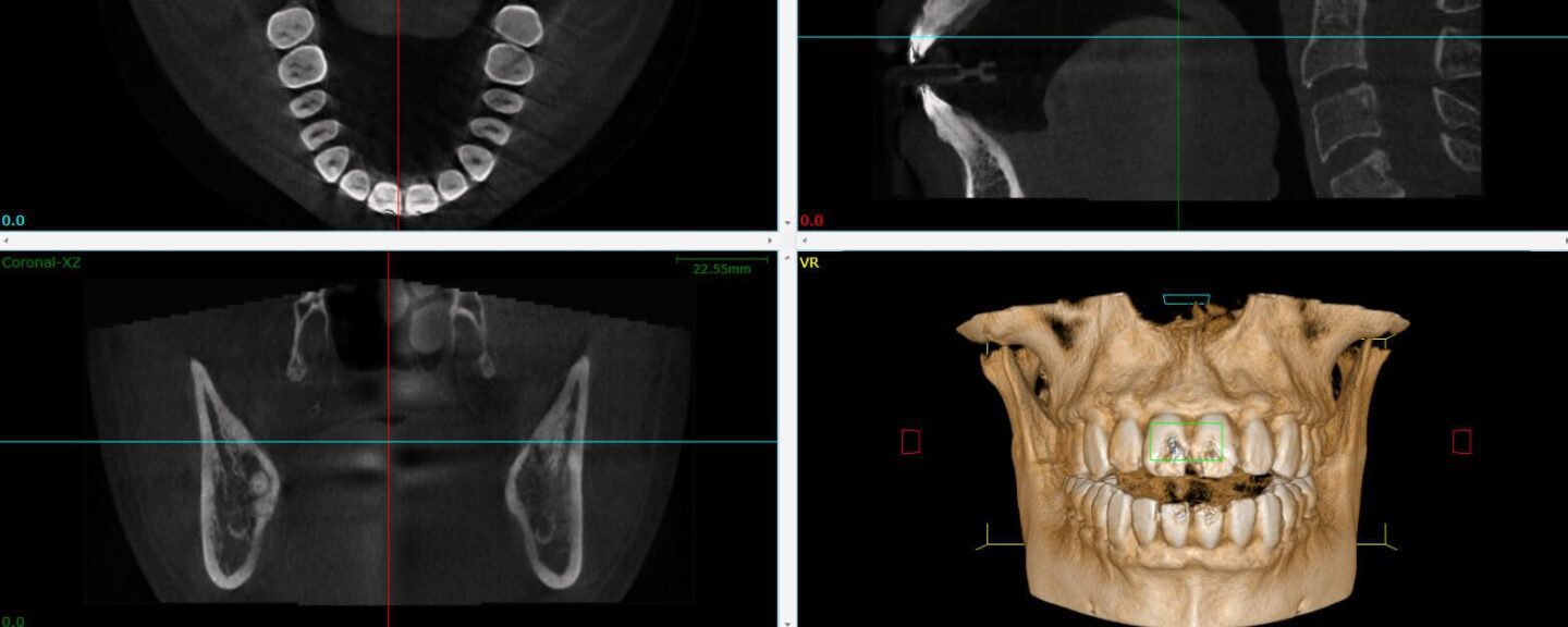 3D Cbct Scan Tech Review & Benchmarks 2026
