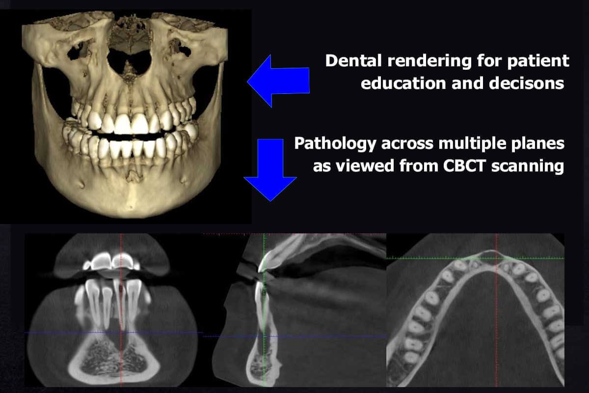 3d cbct scan