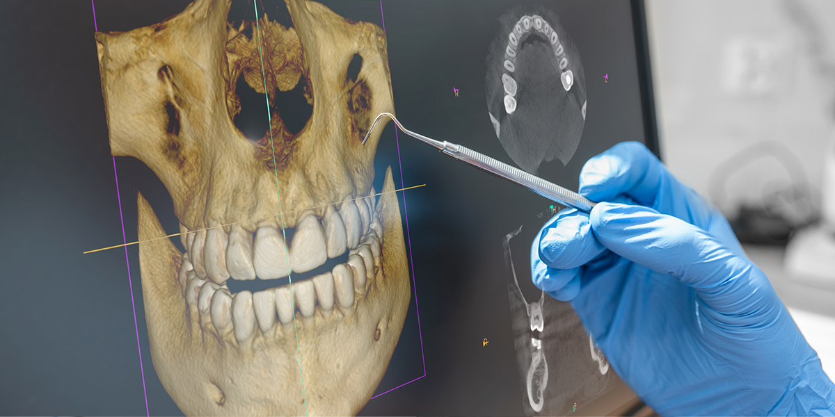 3d dental microscope