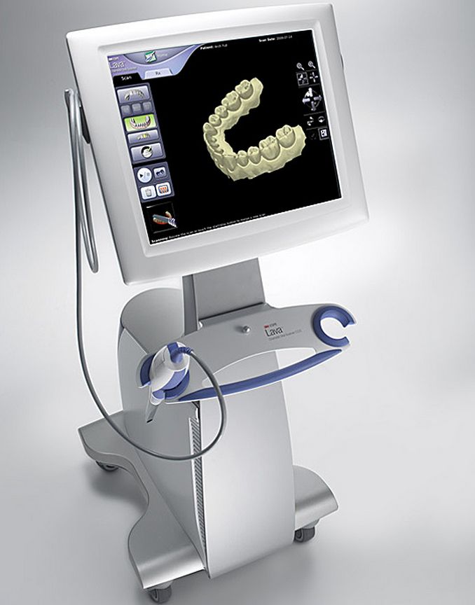 3d scanner dental