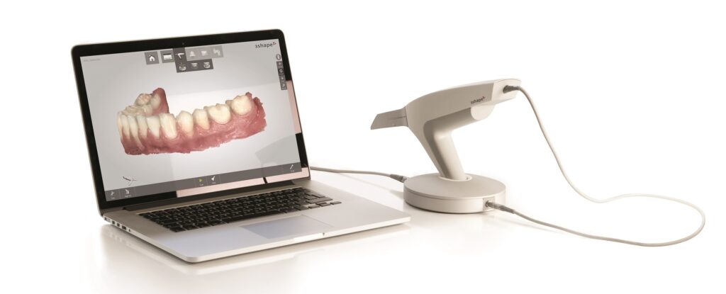 3d shape trios scanner digital dentistry