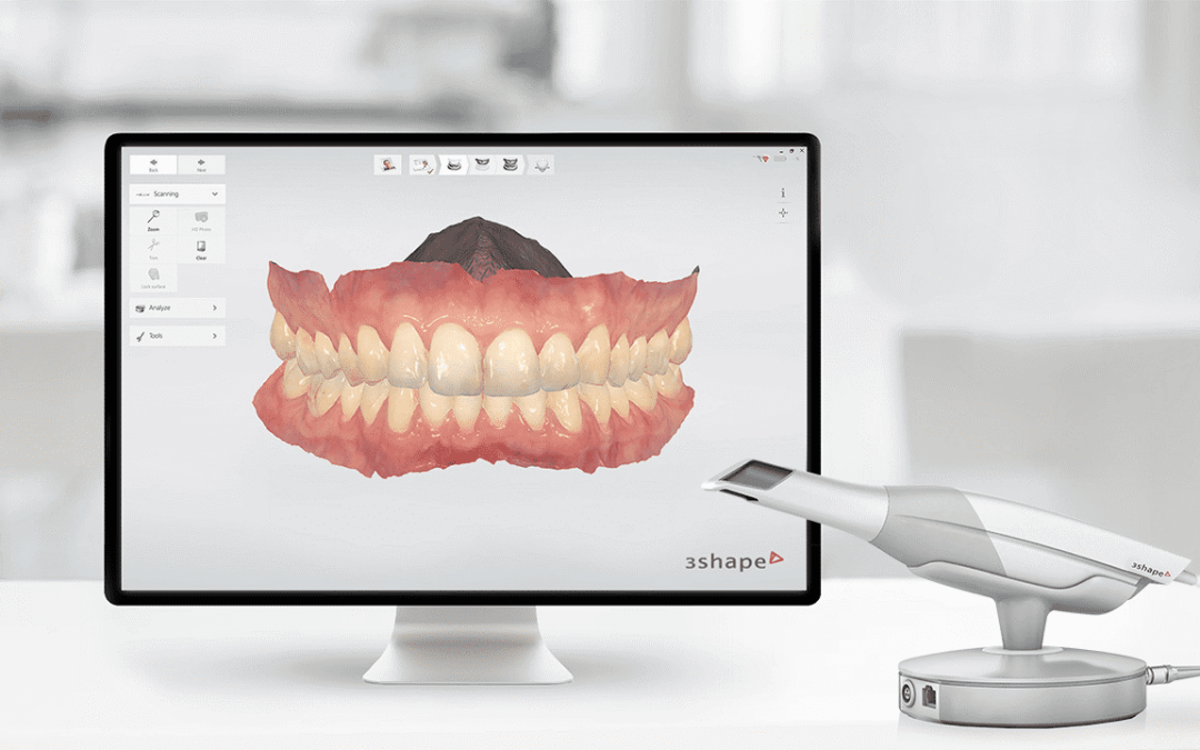 3d teeth scanner