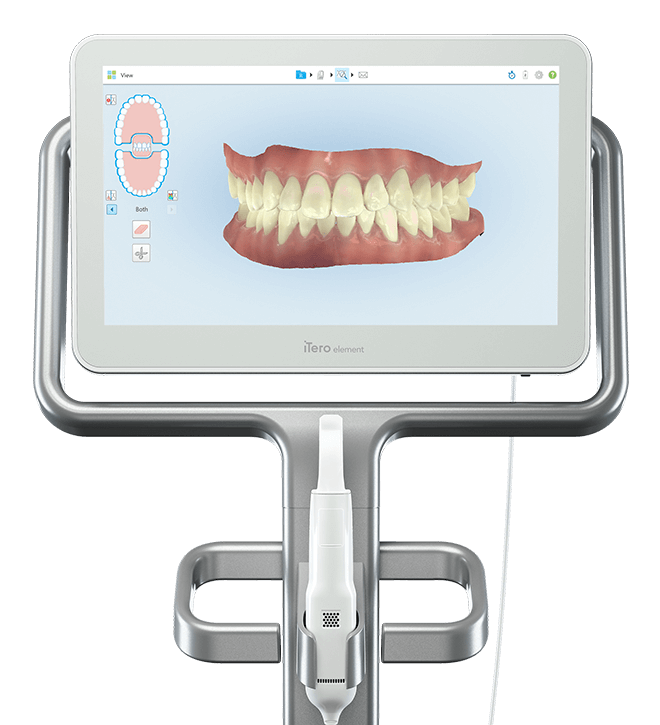 3d teeth scanner