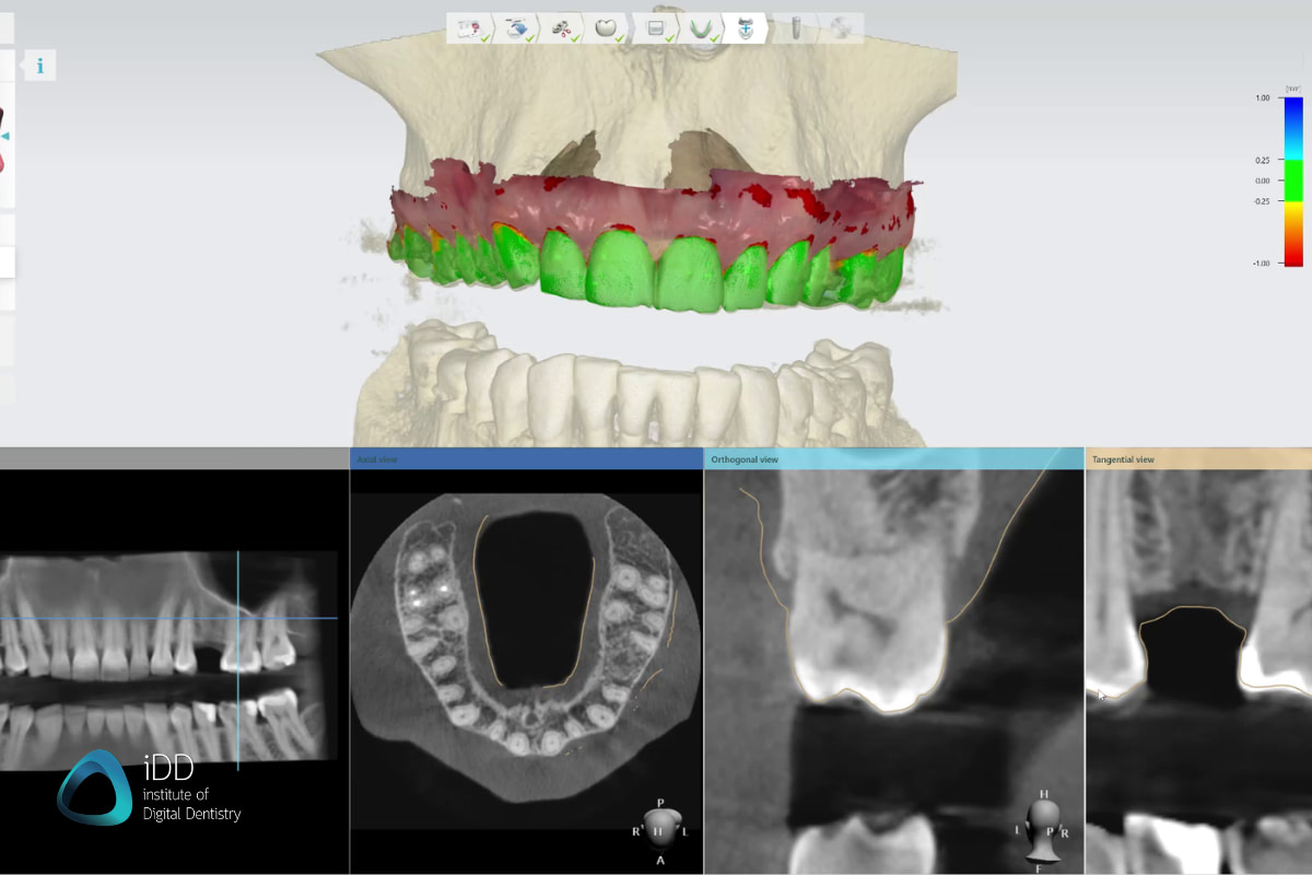 best dental cbct