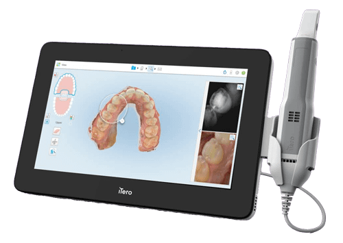 best intraoral scanner 2021