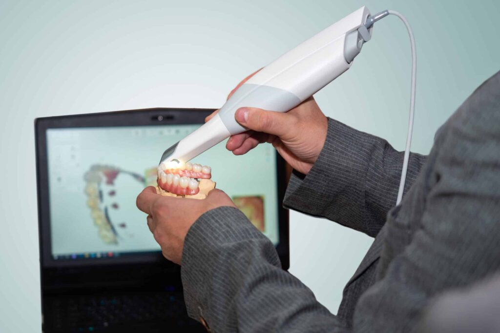 cad cam scanner digital dentistry