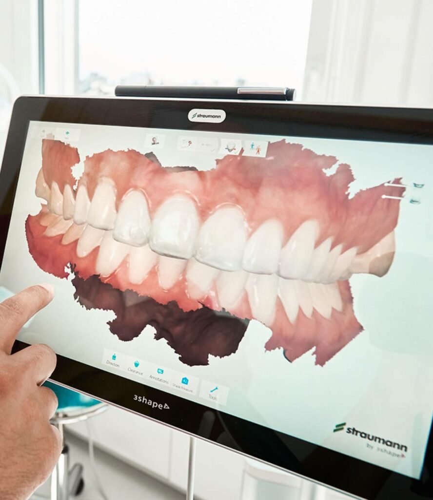 camera optique dentaire digital dentistry