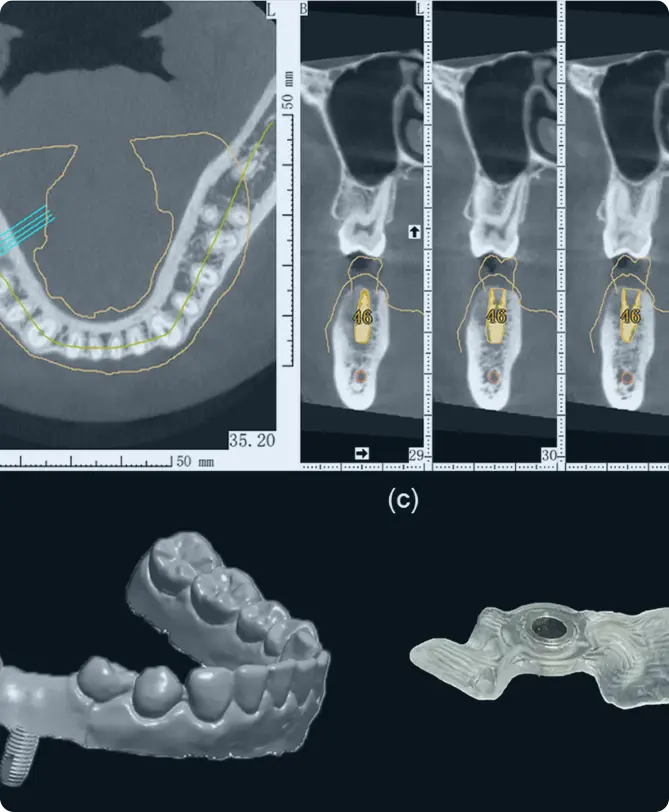 cbct dental precio