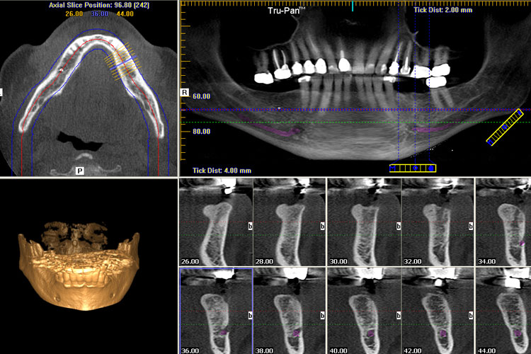 cbct scan