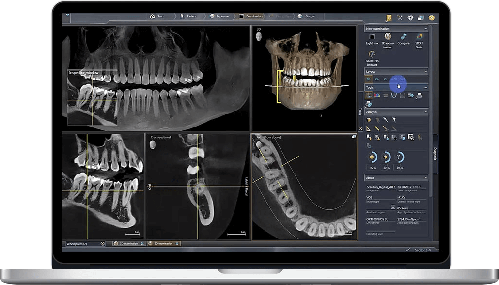 cbct scan dental