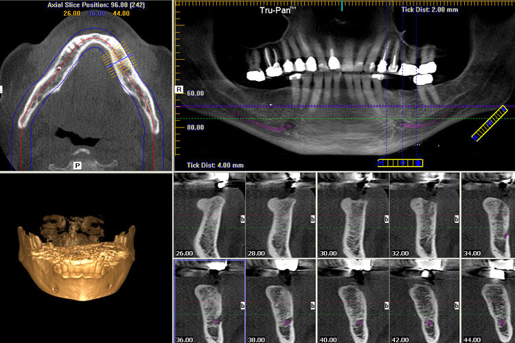 cbct scan dental