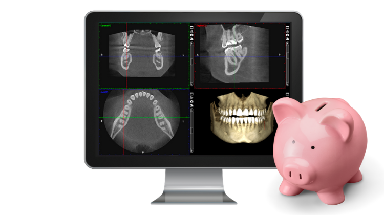 cbct scan dental cost digital dentistry