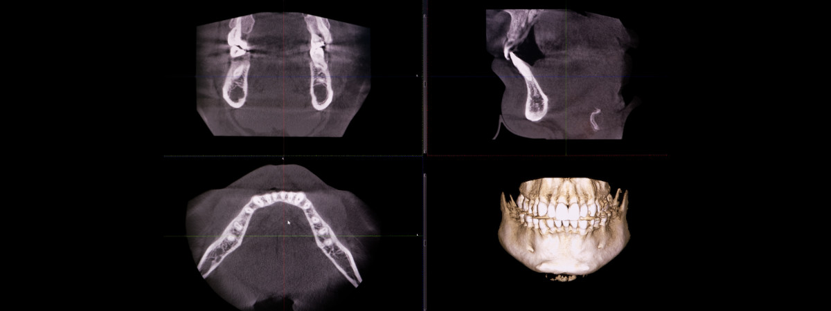 Cbct Snimka Zuba Tech Review & Benchmarks 2026