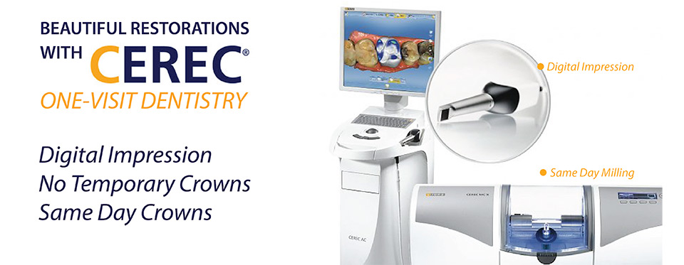 cerec crown machine
