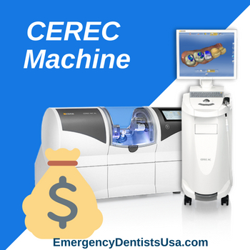 cerec machine cost