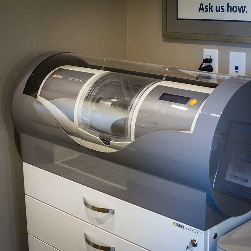 cerec machine dental