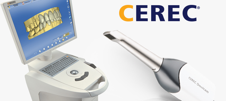 cerec scanner