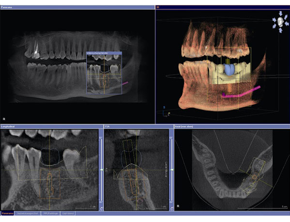 dental cbct