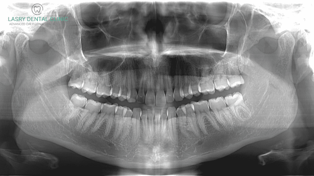 dental ct scan cost