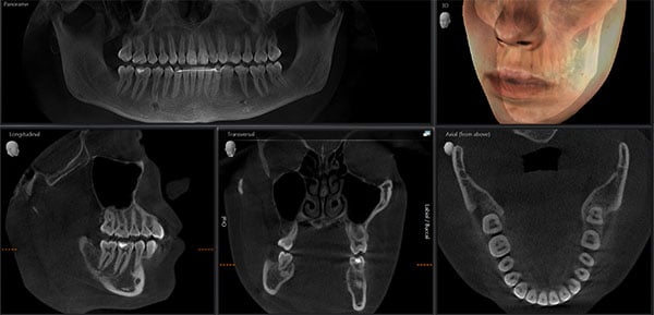 dental ct scan cost