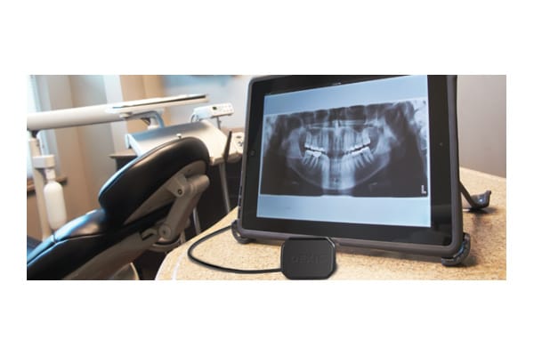 dental digital x ray machine price