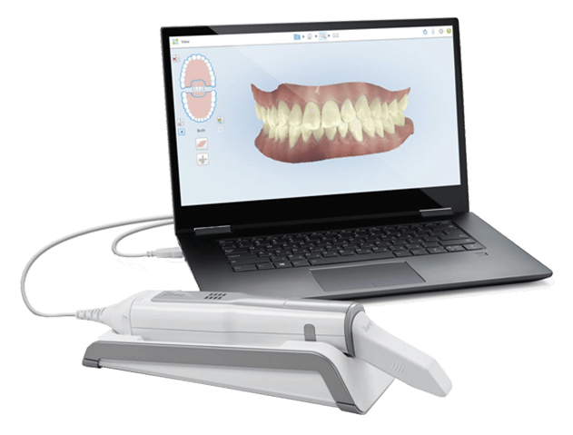 dental scanner brands
