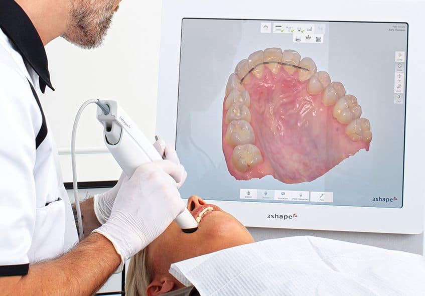 dental scanner for crowns